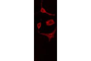 ABIN6269317 staining HuvEc cells by IF/ICC. (Caveolin-1 antibody  (N-Term))