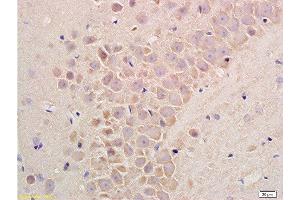 Formalin-fixed and paraffin embedded rat liver tissue labeled with Rabbit Anti-Substance P Polyclonal Antibodyat 1:200 followed by conjugation to the secondary antibody and DAB staining. (Substance P antibody  (AA 58-68))