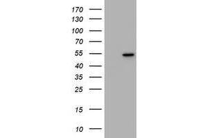 Image no. 1 for anti-Vimentin (VIM) antibody (ABIN1501719) (Vimentin antibody)