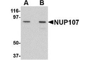 Western Blotting (WB) image for anti-Nucleoporin 107kDa (NUP107) (C-Term) antibody (ABIN1030552) (NUP107 antibody  (C-Term))