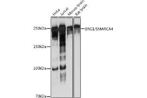 Western blot analysis of extracts of various cell lines, using BRG1/SM antibody (ABIN7270655) at 1:1000 dilution. (SMARCA4 antibody)