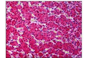 Human Adrenal: Formalin-Fixed, Paraffin-Embedded (FFPE) (KCNN4 antibody  (AA 227-239))