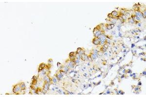 Immunohistochemistry of paraffin-embedded Mouse lung using ATG7 Polyclonal Antibody at dilution of 1:100 (40x lens). (ATG7 antibody)