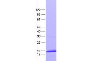 Validation with Western Blot (LSM4 Protein (His tag))