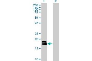 Western Blot analysis of IFNA1 expression in transfected 293T cell line by IFNA1 MaxPab polyclonal antibody. (IFNA1 antibody  (AA 1-189))