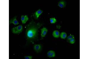 Immunofluorescence staining of MCF-7 cells with ABIN7167068 at 1:200, counter-stained with DAPI. (LAMTOR1 antibody  (AA 2-161))