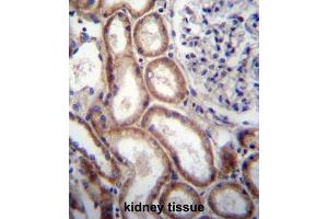 Immunohistochemistry (IHC) image for anti-Slit Homolog 1 (SLIT1) antibody (ABIN2997309) (SLIT1 antibody)