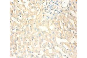 Immunohistochemistry of paraffin-embedded human liver tissue using ABIN7159537 at dilution of 1:100 (MT1X antibody  (AA 1-59))