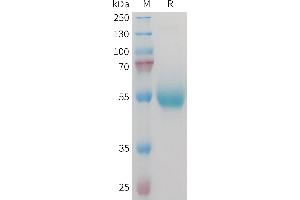 Mouse CD70 Protein, hFc Tag on SDS-PAGE under reducing condition. (CD70 Protein (Fc Tag))