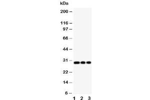 Western blot testing of HLA-DM antibody and Lane 1:  Jurkat (HLA-DMB antibody  (Middle Region))