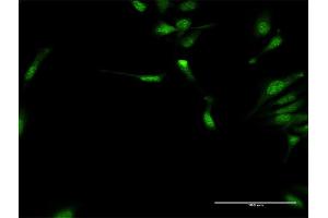 Immunofluorescence of purified MaxPab antibody to DYX1C1 on HeLa cell. (DYX1C1 antibody  (AA 1-381))
