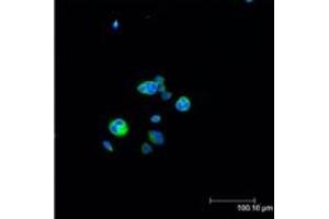 Immunofluorescent analysis (confocal) staining of HeLa cells using Hsp27 (pSer15) pAb (green), nuclei are stained in blue pseudocolor using DRAQ. (HSP27 antibody  (pSer15))