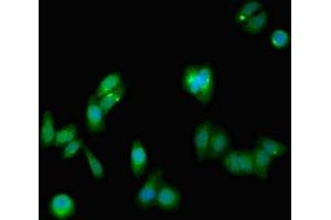 Immunofluorescent analysis of HepG2 cells using ABIN7161294 at dilution of 1:100 and Alexa Fluor 488-congugated AffiniPure Goat Anti-Rabbit IgG(H+L) (Notch1 antibody  (AA 2428-2555))