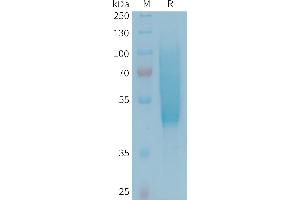 Human CX3CL1 Protein, His Tag on SDS-PAGE under reducing condition. (CX3CL1 Protein (AA 25-341) (His tag))