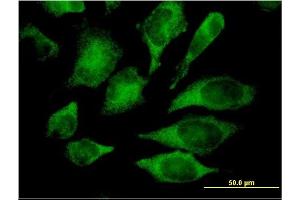 Immunofluorescence of monoclonal antibody to MAPK13 on HeLa cell. (MAPK13 antibody  (AA 251-365))