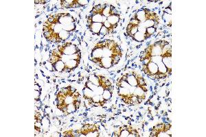 Immunohistochemistry of paraffin-embedded human colon using TOMM22 Rabbit mAb (ABIN7270930) at dilution of 1:100 (40x lens). (TOMM22 antibody)