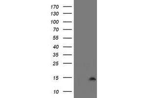 Image no. 1 for anti-Cystatin SA (CST2) antibody (ABIN1497757) (CST2 antibody)