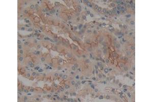 Used in DAB staining on fromalin fixed paraffin- embedded kidney tissue (PTPRE antibody  (AA 346-500))