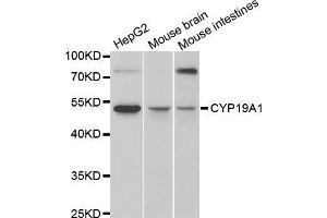 Western blot analysis of extracts of various cell lines, using CYP19A1 antibody (ABIN5971188) at 1/1000 dilution. (Aromatase antibody)