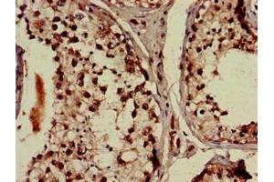 Immunohistochemistry of paraffin-embedded human testis tissue using ABIN7164355 at dilution of 1:100 (DDX4 antibody  (AA 1-223))