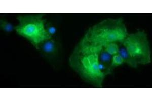 Image no. 1 for anti-CD19 Molecule (CD19) antibody (ABIN1497185) (CD19 antibody)