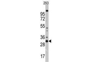 Image no. 1 for anti-Cyclin-Dependent Kinase 1 (CDK1) (N-Term) antibody (ABIN357035) (CDK1 antibody  (N-Term))