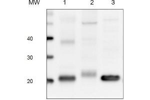Western Blotting (WB) image for PEB (4x), protein extraction buffer (ABIN618925) (PEB (4x), protein extraction buffer)
