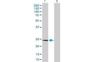 Western Blot analysis of C1QC expression in transfected 293T cell line by C1QC MaxPab polyclonal antibody. (C1QC antibody  (AA 1-245))