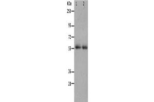 Western Blotting (WB) image for anti-Matrix Metallopeptidase 17 (Membrane-inserted) (MMP17) antibody (ABIN2426215) (MMP17 antibody)