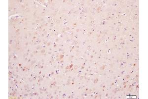 Formalin-fixed and paraffin embedded rat brain labeled with Anti-Phospho-MAPKAPK2(Ser272)Polyclonal Antibody, Unconjugated (ABIN710531) at 1:200, followed by conjugation to the secondary antibody and DAB staining (MAPKAP Kinase 2 antibody  (pSer272))