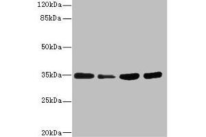 Western blot All lanes: UFD1 antibody at 3. (UFD1L antibody  (AA 1-307))