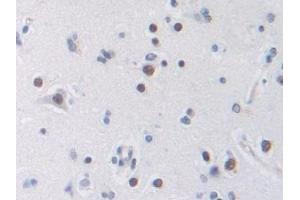 Detection of TFR in Human Cerebrum Tissue using Polyclonal Antibody to Transferrin Receptor (TFR) (Transferrin Receptor antibody  (AA 567-744))