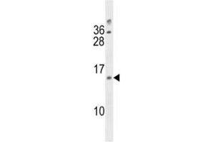 DUSP13 antibody western blot analysis in A2058 lysate (DUSP13 antibody  (AA 147-173))