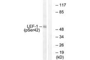 Western blot analysis of extracts from 293 cells treated with paclitaxel 1uM 24h, using LEF-1 (Phospho-Ser42) Antibody. (LEF1 antibody  (pSer42))