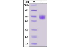 Cynomolgus Mesothelin (296-580), His Tag on  under reducing (R) condition. (Mesothelin Protein (MSLN) (AA 296-580) (His tag))