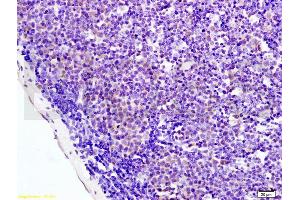 Formalin-fixed and paraffin embedded mouse colon labeled with Anti-AMPK alpha-1/PRKAA1 Polyclonal Antibody, Unconjugated (ABIN737886) at 1:200 followed by conjugation to the secondary antibody and DAB staining. (PRKAA1 antibody  (AA 351-450))