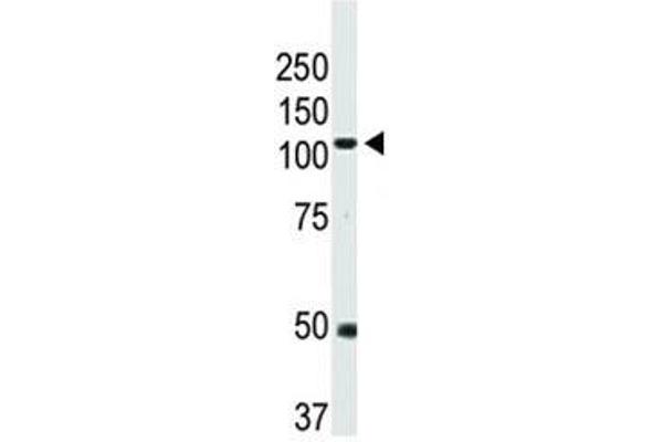 BMPR2 antibody  (AA 28-59)