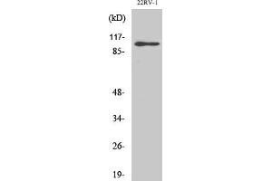 Western Blot analysis of various cells using GluR-2 Polyclonal Antibody. (GRIA2 antibody)