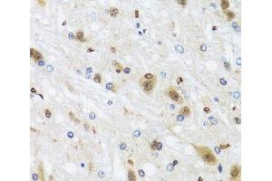 Immunohistochemistry of paraffin-embedded Rat brain using HDAC4 Polyclonal Antibody at dilution of 1:100 (40x lens). (HDAC4 antibody)