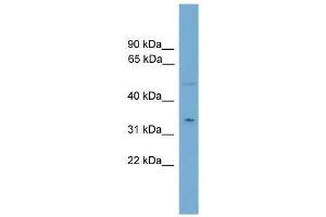 Western Blot showing MGLL antibody used at a concentration of 1-2 ug/ml to detect its target protein. (MGLL antibody  (N-Term))