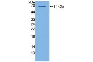 Detection of Recombinant PI4Ka, Human using Polyclonal Antibody to Phosphatidylinositol-4-Kinase Catalytic Alpha (PI4Ka) (PI4KA antibody  (AA 1-300))