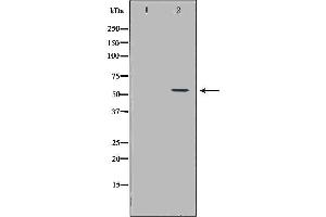 Western blot analysis of A549 cell lysate, using ICAM1 Antibody. (ICAM1 antibody  (C-Term))