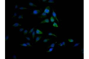 Immunofluorescence staining of Hela Cells with ABIN7127802 at 1:50, counter-stained with DAPI. (Recombinant SAE1 antibody)