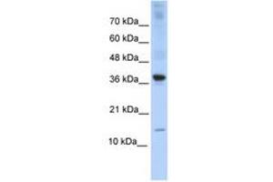 Image no. 1 for anti-Basic Leucine Zipper ATF-like Transcription Factor (BATF) (AA 35-84) antibody (ABIN6740310) (BATF antibody  (AA 35-84))