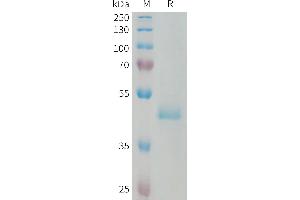 Human PIP Protein, hFc Tag on SDS-PAGE under reducing condition. (PIP Protein (AA 29-146) (Fc Tag))