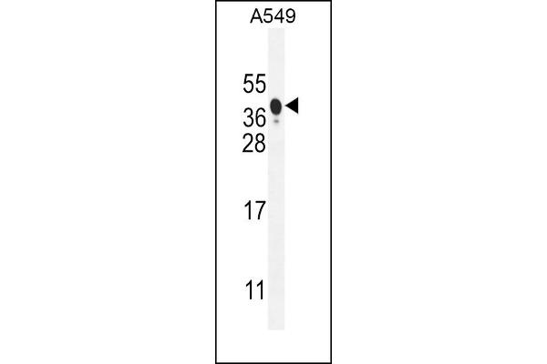 BNIP3L/NIX antibody  (AA 52-81)