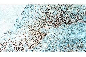 Human tonsil: immunohistochemical staining for Retinoblastoma Gene Protein. (Retinoblastoma Protein (Rb) antibody  (N-Term))