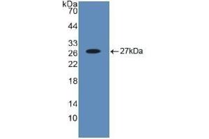 使用BH3相互作用域死亡激动剂（Bid）多克隆抗体（Bid抗体（AA 1-195））检测人重组Bid