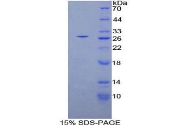 Phospholipase C gamma 1 Protein