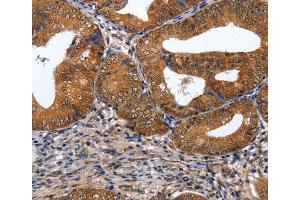 Immunohistochemistry (IHC) image for anti-GATA Binding Protein 6 (GATA6) antibody (ABIN2431397) (GATA6 antibody)